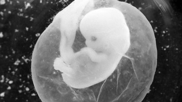 Ein Embryo in einer transparenten Membran, möglicherweise im Mutterleib.