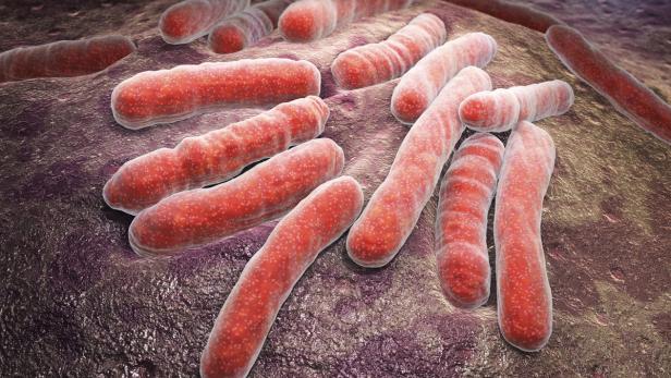Tuberkulose-Bakterien: Robert Koch entdeckte sie 1882