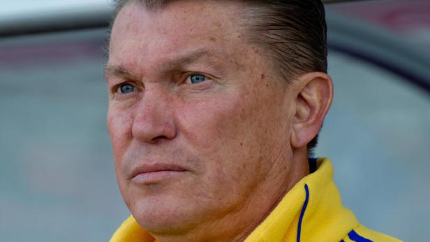 Nahaufnahme eines Mannes mit hellblauen Augen und gelbem Oberteil.