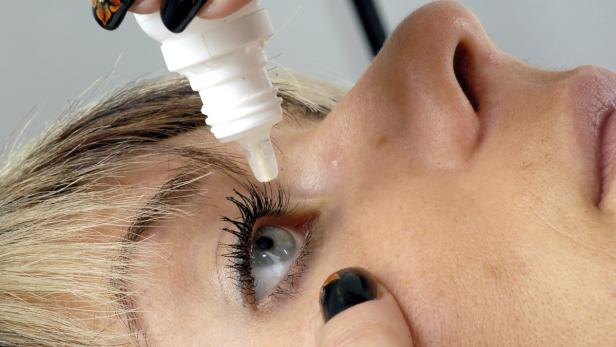 90 Prozent der Patienten helfen spezielle Augentropfen.