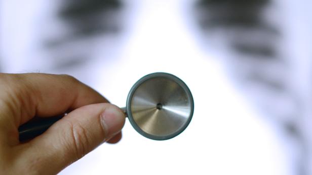 Eine Hand hält ein Stethoskop vor einem Röntgenbild des Brustkorbs.