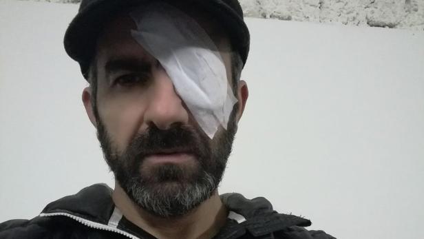 Thaer Maarouf mit einem Verband über dem linken Auge