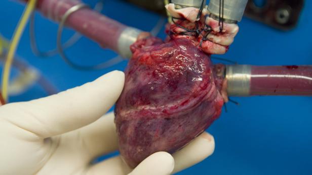 Ein menschliches Herz wird von einer Hand mit einem medizinischen Handschuh gehalten.