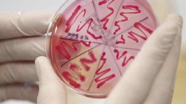 Ein mit Handschuhen bekleideter Wissenschaftler hält eine Petrischale mit roten Bakterienkulturen.