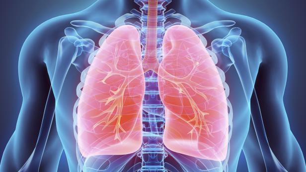 Drei der sechs häufigsten Todesursachen sind bald Lungenkrankheiten.