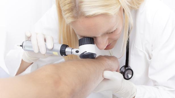 Eine Ärztin untersucht die Haut eines Patienten mit einem Dermatoskop.