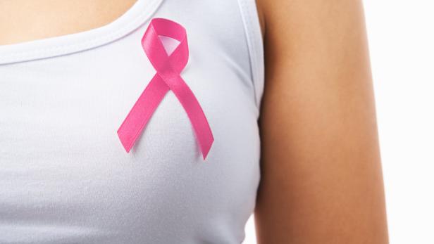 Ziel: 2030 soll keine Frau mehr an Brustkrebs sterben