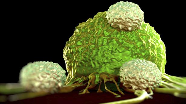 Eine Nahaufnahme einer Krebszelle, die von Immunzellen angegriffen wird.