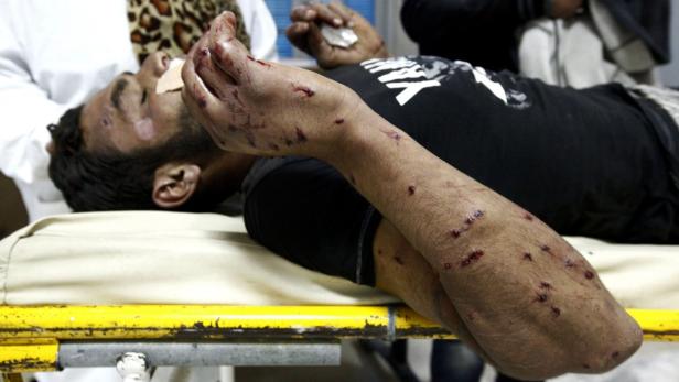 Ein Mann liegt mit blutenden Wunden auf einer Trage.