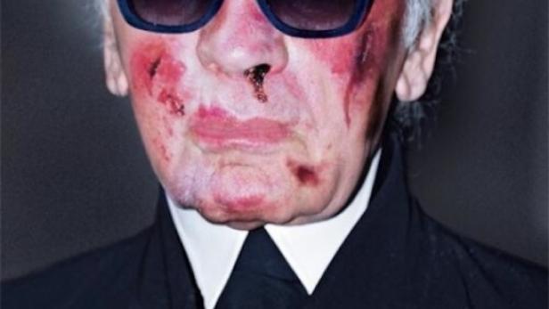 Ein Mann mit blutigem Gesicht und Sonnenbrille, vermutlich eine Darstellung gegen Folter von Amnesty International.