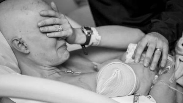 Eine Frau mit Glatze liegt im Krankenhausbett, eine Hand vor dem Gesicht.