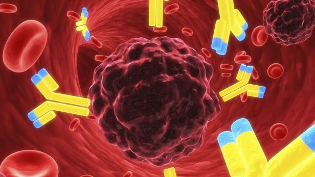 Antikörper können Krebszellen direkt attackieren (Bild), oder sie können die Blockade des Immunsystems durch die Krebszellen aufheben