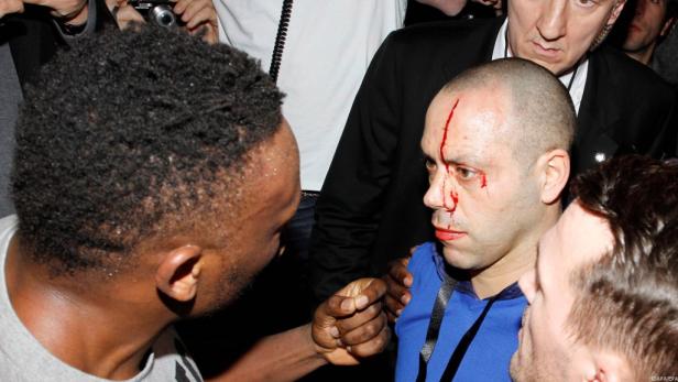 Ein Mann mit einer blutenden Wunde im Gesicht wird von anderen gestützt.