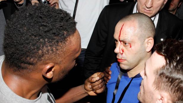 Ein Mann mit blutendem Gesicht wird von anderen gestützt.