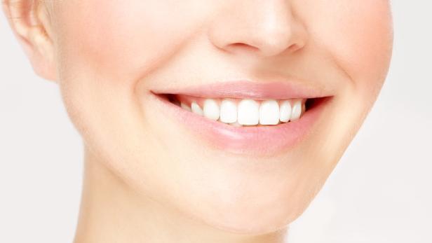Strahlend weiße Zähne gelten als Schönheitsideal