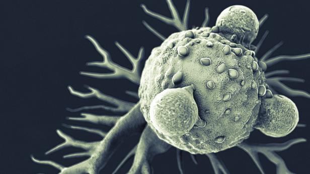 Eine Krebszelle wird von Abwehrzellen attackiert