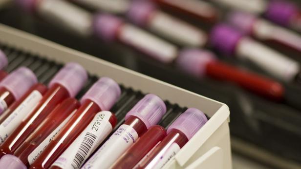 Blutproben in Röhrchen mit violetten Deckeln in einem Labor.