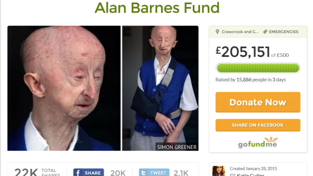 Ein Spendenaufruf für Alan Barnes, der an einer seltenen Krankheit leidet.