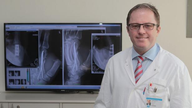 Ein Arzt steht vor einem Monitor, der Röntgenaufnahmen von Händen zeigt.