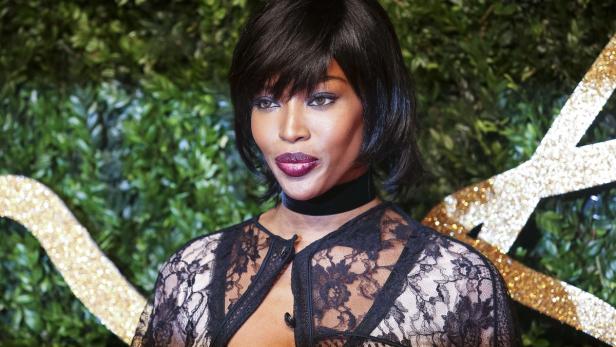 Braucht Naomi Campbell eine neue Hüfte?