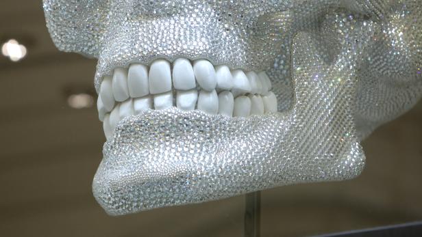 Neue Erkenntnis: Auch Gendefekte können die Zähne angreifen