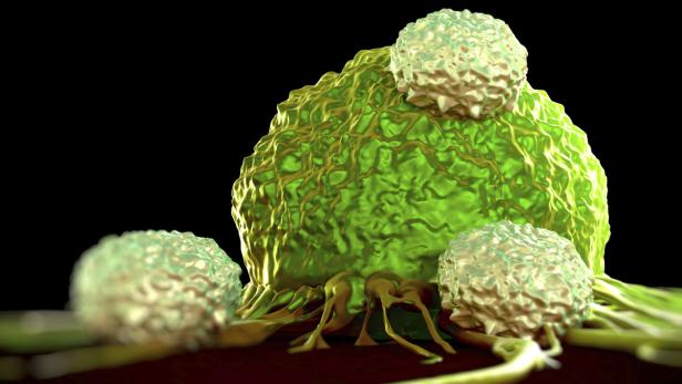 Eine Krebszelle, die von Abwehrzellen attackiert wird