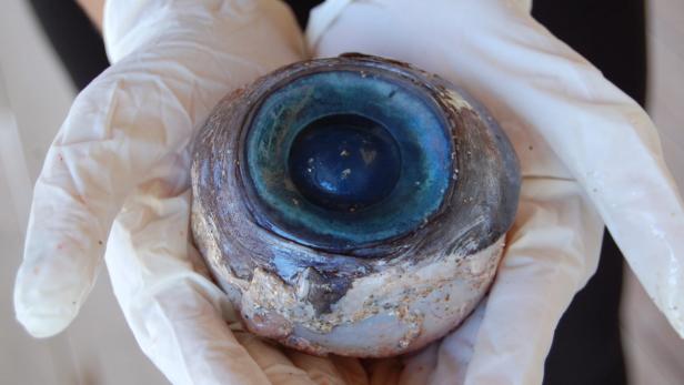 Ein riesiger, blauer Augapfel wird von behandschuhten Händen gehalten.