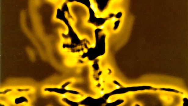 Das Cover des Albums „Smash“ von The Offspring zeigt ein stilisiertes Skelett.