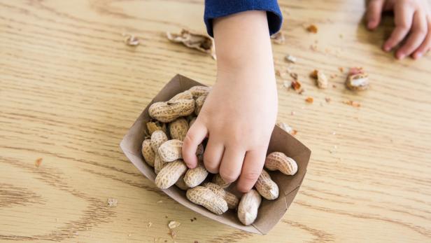 Erdnüsse können heftige allergische Reaktionen auslösen.
