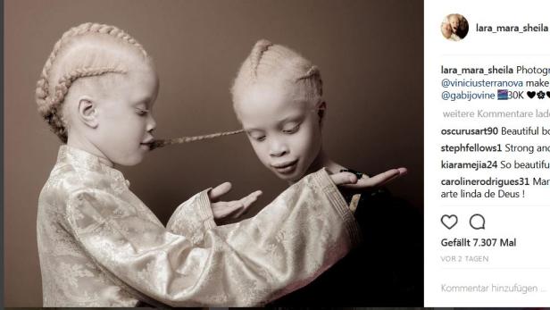 Albino-Zwillinge, die Karriere machen