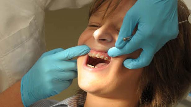 Zahnspangen für Kinder und Jugendliche mit gravierenden Fehlstelllungen