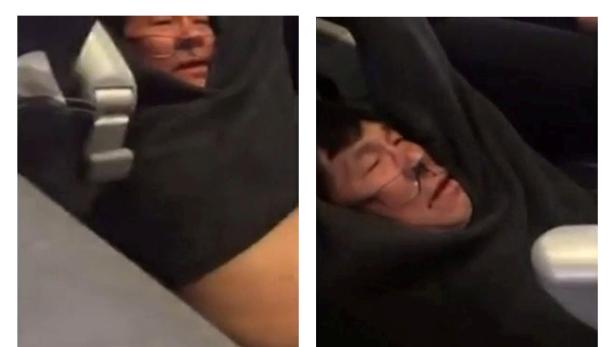United Airlines schloss Vergleich mit Passagier nach Rauswurf