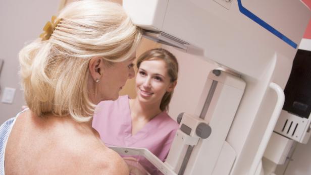 Bisher gehen nicht mehr Frauen zur Mammografie.