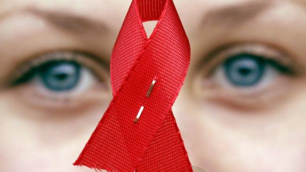 Aids: 2,1 Millionen Neuinfektionen pro Jahr