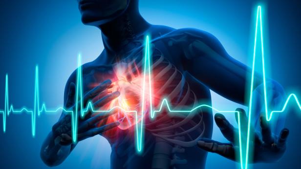 Sterblichkeit durch Herzerkrankungen drastisch gesunken