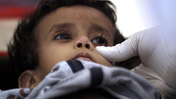 Ein Kind wird in einem Spital in Sanaa behandelt.