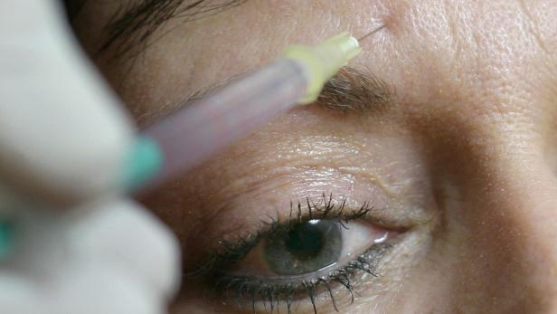Das Nervengift Botox wird zur Falten-Bekämpfung eingesetzt.
