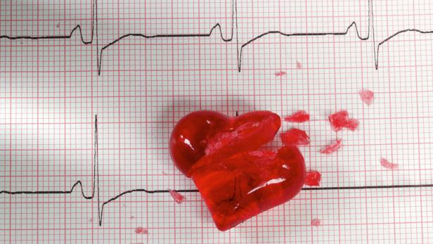 Rund 17.000 Menschen in Österreich erleiden jährlich einen Herzinfarkt.