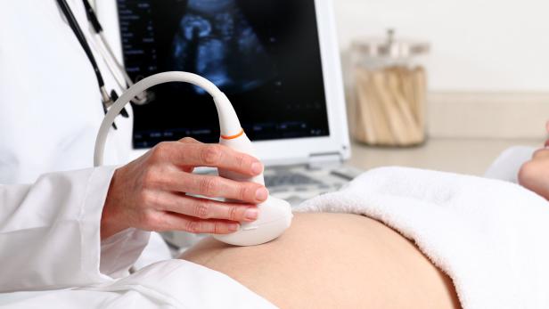 Eine schwangere Frau wird von einem Arzt mit Ultraschall untersucht.