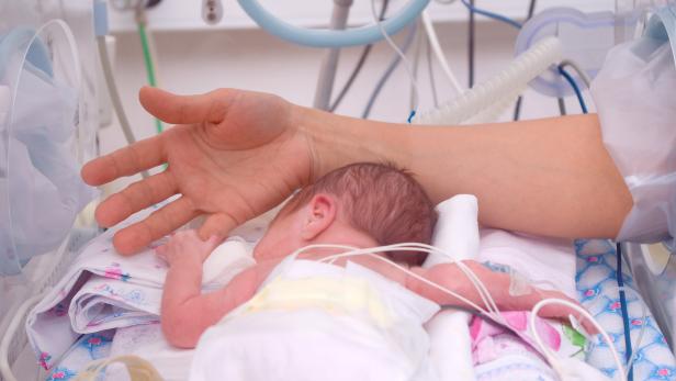 Der Wiener Krankenanstaltenverbund evaluiert derzeit die neonatologische Versorgung.
