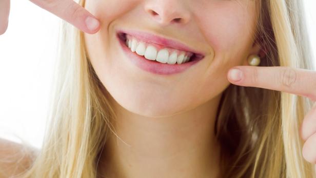 Zahnbeläge und Bakterien begünstigen Karies.