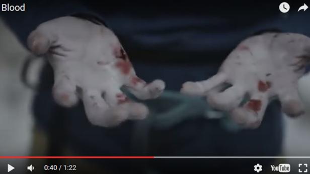 Diese Binden-Werbung zeigt Blut