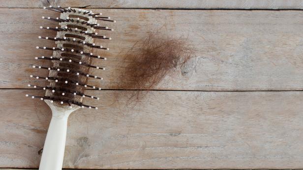 Eine neue Studie hat sich Haarausfall-Suchanfragen näher gewidmet.