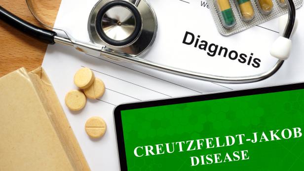 Creutzfeldt-Jakob ist eine unheilbare Krankheit.