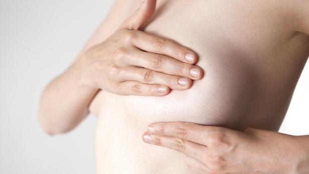 Brustkrebs bei Frauen: Hilft ihnen ein Gen-Test?