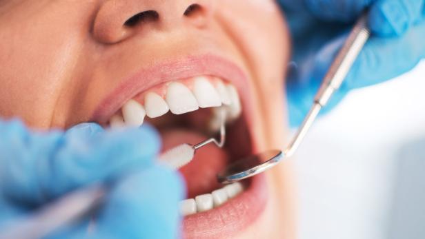 Entzündungsherde im Mund können zum Zahnverlust führen.