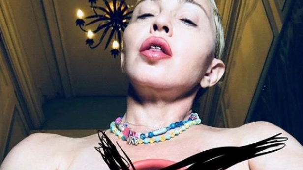 Nackt & sabbernd: Sorge um Madonna