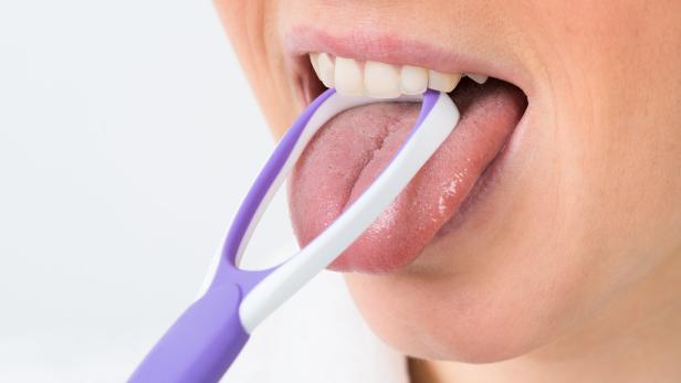 Einmal täglich die Zunge zu reinigen, kann Mundgeruch verbessern.