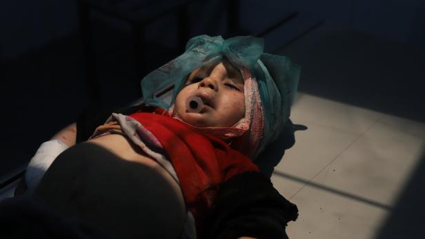 Ein verletztes Kind in einem provisorischen Spital in Ost-Ghouta.