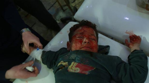 Verletztes Kind in  provisorischem Spital in Ost-Ghouta